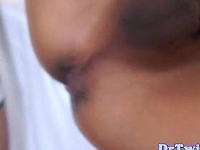 Asian MD slams patient after enema bch chinese gay porn